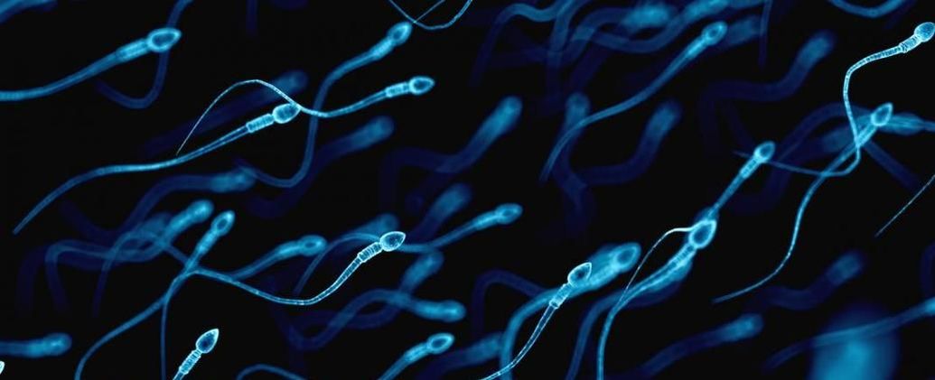 Japanese Schoolgirl Has Diarrhea Porn - Different sperm colors explained - Dr Tony Bushati - Obstetrician &  Gynaecologist
